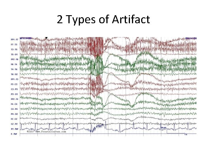 2 Types of Artifact 