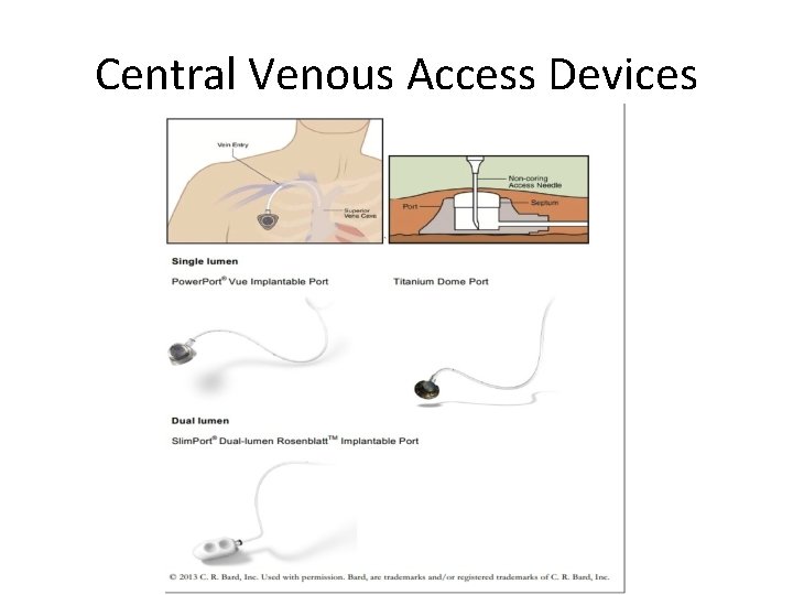 Central Venous Access Devices 