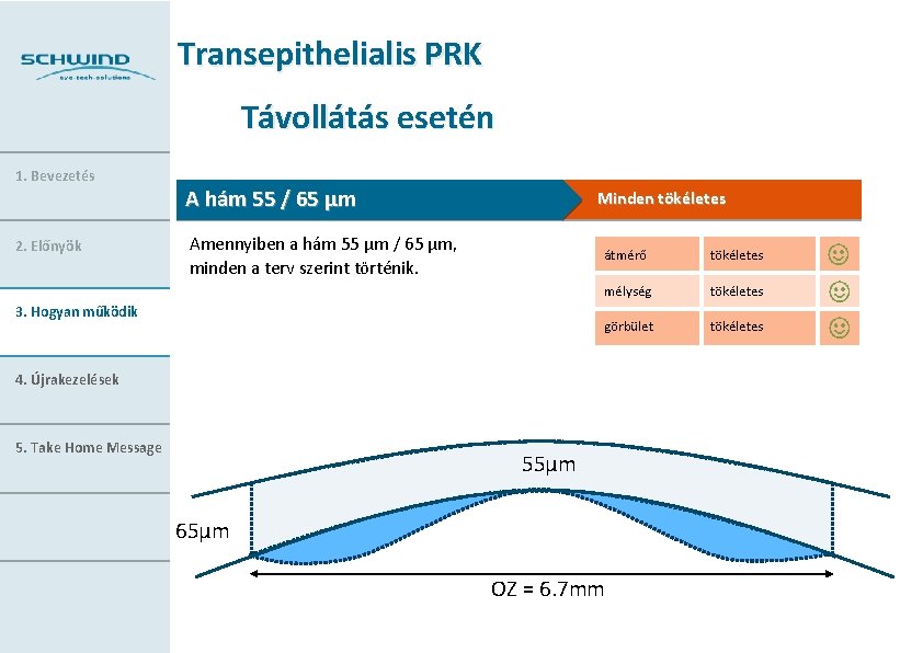 Transepithelialis PRK Távollátás esetén 1. Bevezetés 2. Előnyök A hám 55 / 65 µm