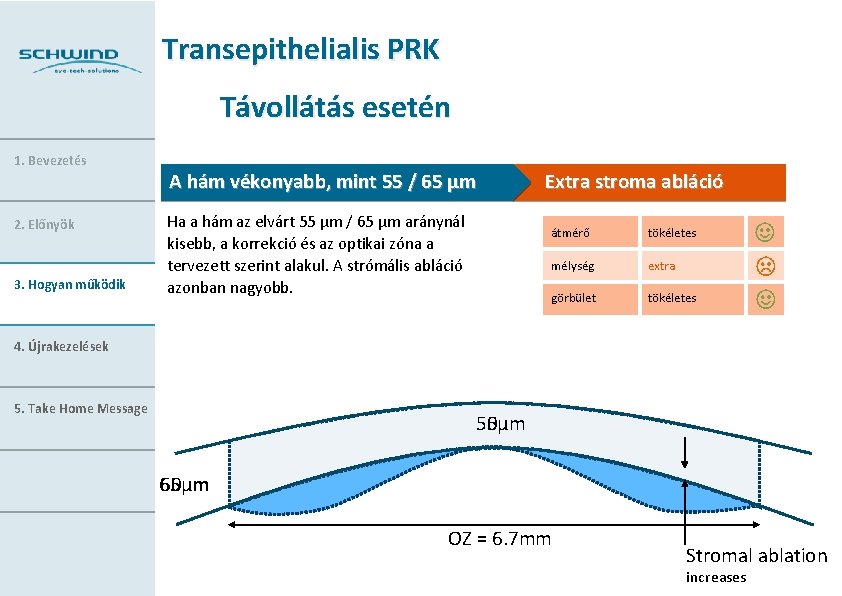 Transepithelialis PRK Távollátás esetén 1. Bevezetés 2. Előnyök 3. Hogyan működik A hám vékonyabb,