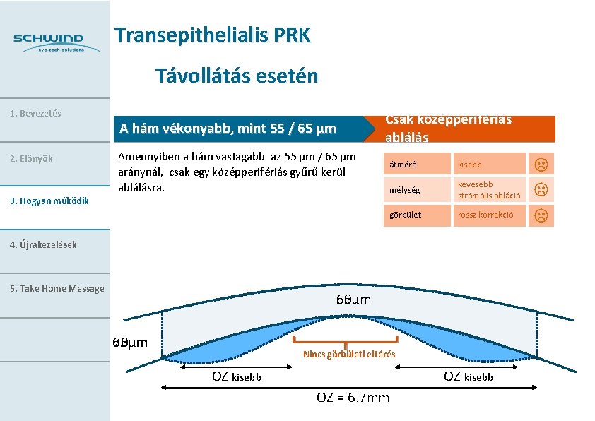 Transepithelialis PRK Távollátás esetén 1. Bevezetés 2. Előnyök 3. Hogyan működik A hám vékonyabb,