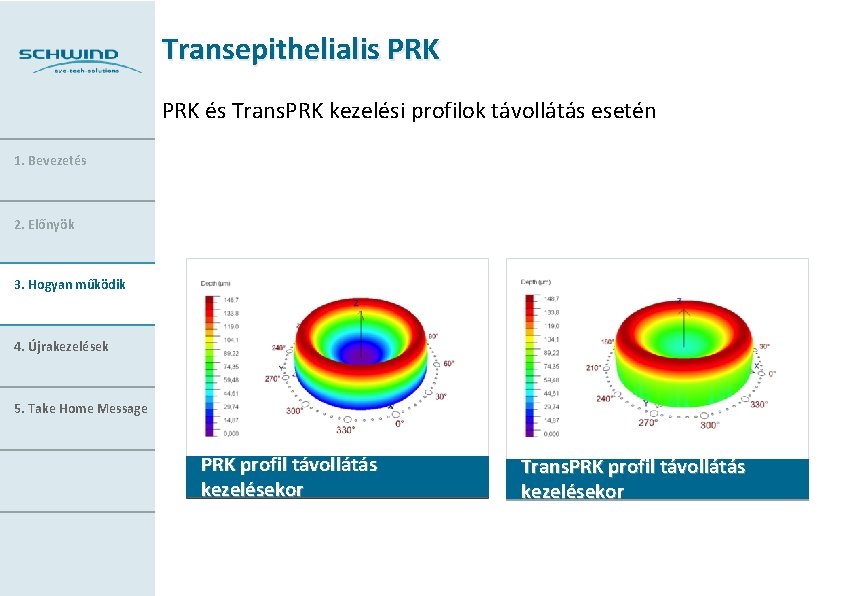 Transepithelialis PRK és Trans. PRK kezelési profilok távollátás esetén 1. Bevezetés 2. Előnyök 3.