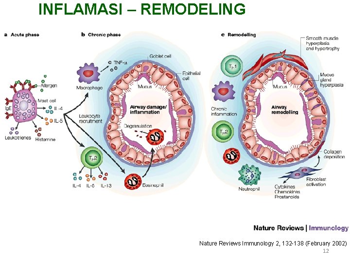 INFLAMASI – REMODELING Nature Reviews Immunology 2, 132 -138 (February 2002) 12 