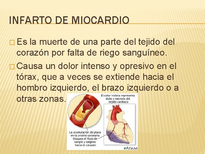 INFARTO DE MIOCARDIO � Es la muerte de una parte del tejido del corazón