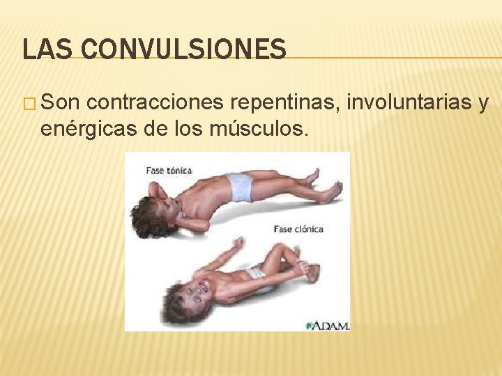 LAS CONVULSIONES � Son contracciones repentinas, involuntarias y enérgicas de los músculos. 