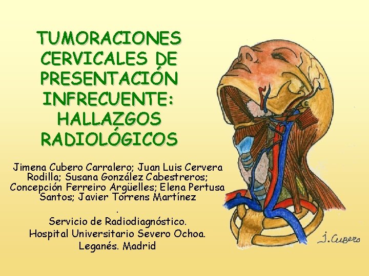 TUMORACIONES CERVICALES DE PRESENTACIÓN INFRECUENTE: HALLAZGOS RADIOLÓGICOS Jimena Cubero Carralero; Juan Luis Cervera Rodilla;