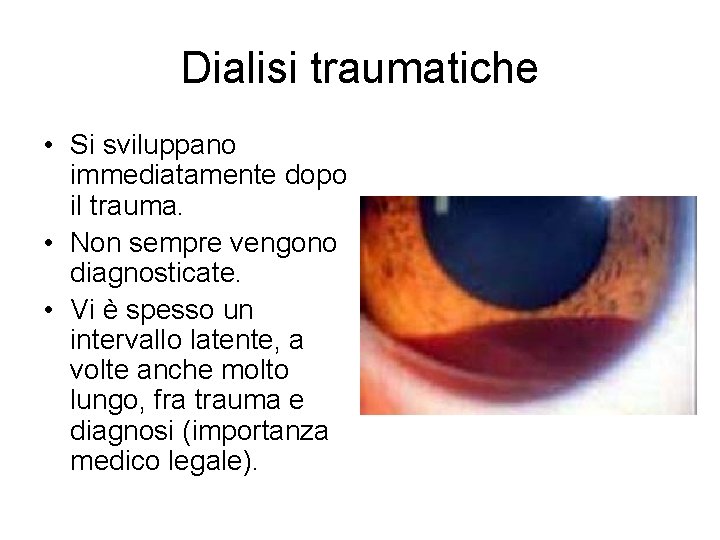 Dialisi traumatiche • Si sviluppano immediatamente dopo il trauma. • Non sempre vengono diagnosticate.