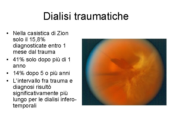 Dialisi traumatiche • Nella casistica di Zion solo il 15, 8% diagnosticate entro 1
