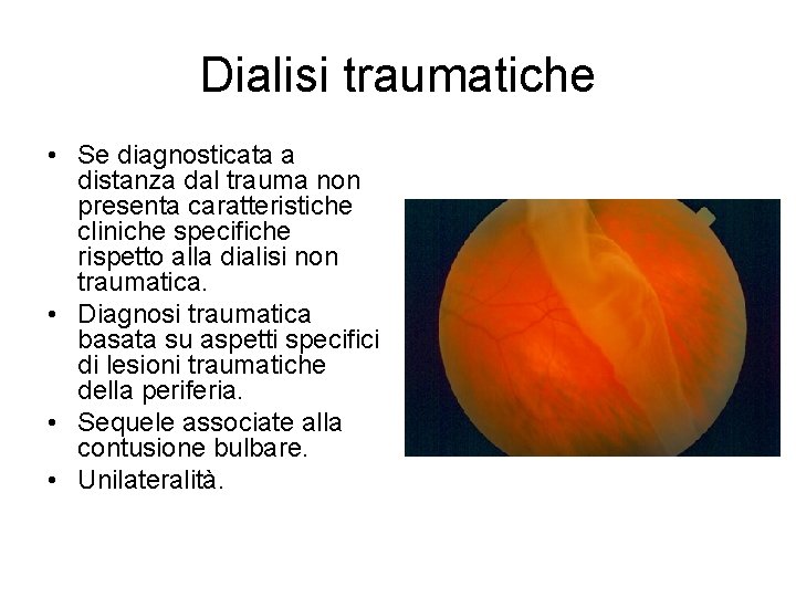 Dialisi traumatiche • Se diagnosticata a distanza dal trauma non presenta caratteristiche cliniche specifiche