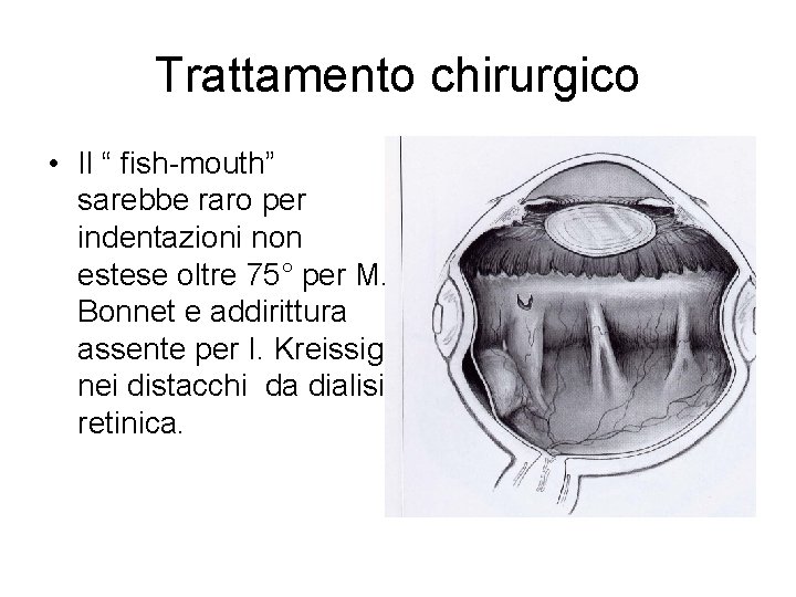 Trattamento chirurgico • Il “ fish-mouth” sarebbe raro per indentazioni non estese oltre 75°