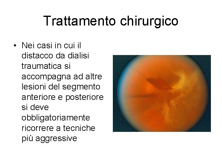Trattamento chirurgico • Nei casi in cui il distacco da dialisi traumatica si accompagna