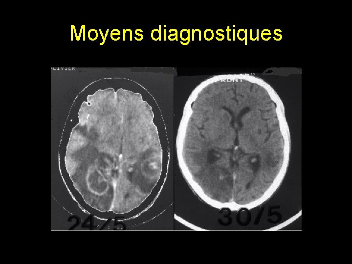 Moyens diagnostiques 