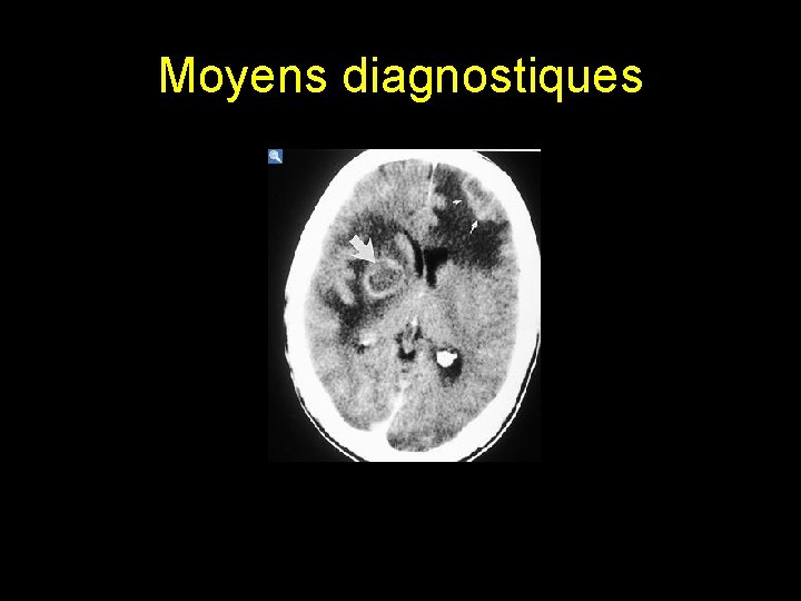 Moyens diagnostiques 