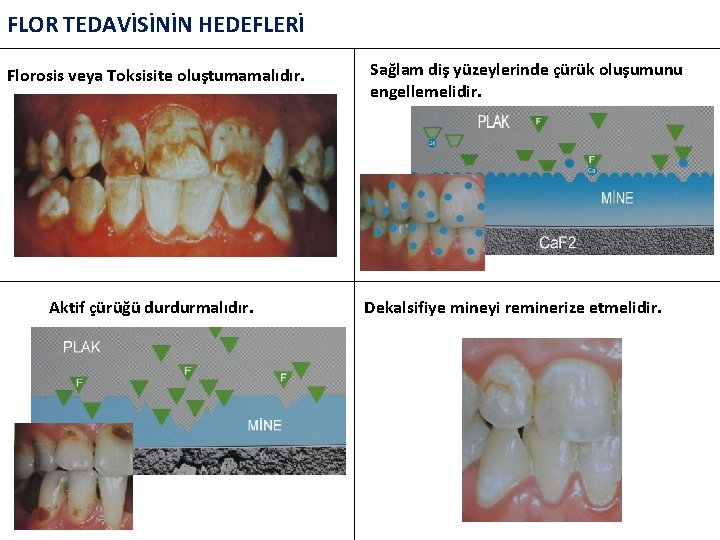 FLOR TEDAVİSİNİN HEDEFLERİ Florosis veya Toksisite oluştumamalıdır. Aktif çürüğü durdurmalıdır. Sağlam diş yüzeylerinde çürük