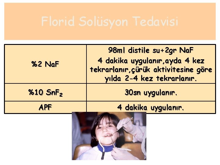 Florid Solüsyon Tedavisi %2 Na. F 98 ml distile su+2 gr Na. F 4
