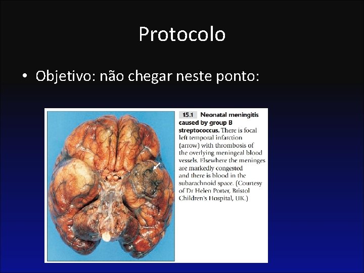 Protocolo • Objetivo: não chegar neste ponto: 