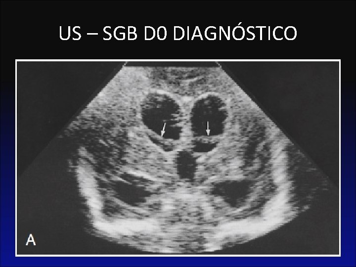 US – SGB D 0 DIAGNÓSTICO 