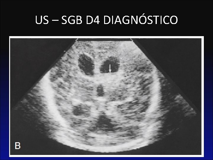 US – SGB D 4 DIAGNÓSTICO 