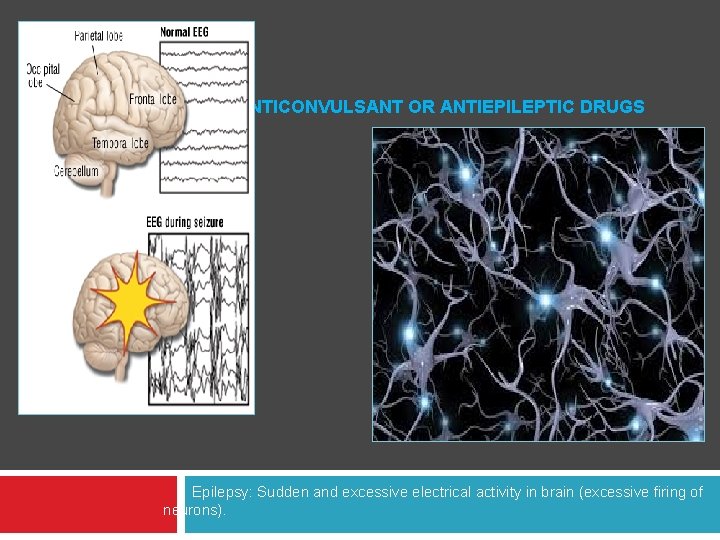 ANTICONVULSANT OR ANTIEPILEPTIC DRUGS Epilepsy: Sudden and excessive electrical activity in brain (excessive firing