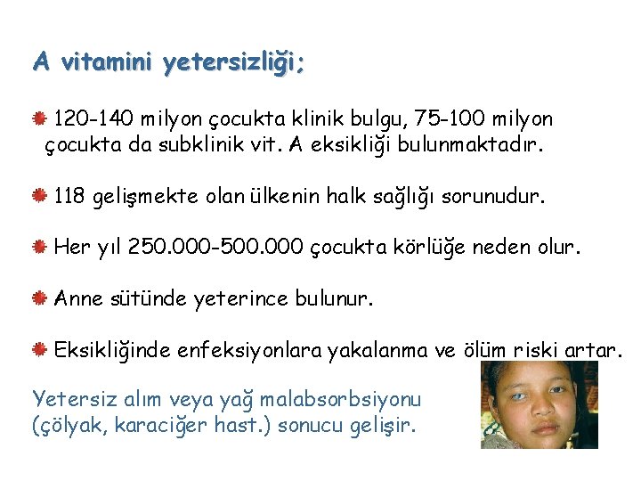 A vitamini yetersizliği; 120 -140 milyon çocukta klinik bulgu, 75 -100 milyon çocukta da