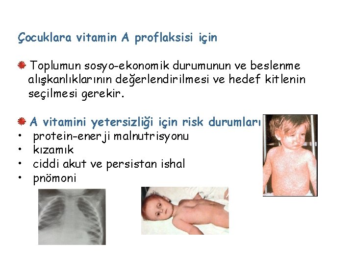 Çocuklara vitamin A proflaksisi için Toplumun sosyo-ekonomik durumunun ve beslenme alışkanlıklarının değerlendirilmesi ve hedef
