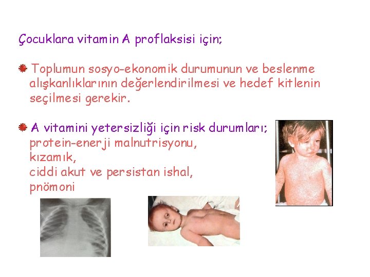Çocuklara vitamin A proflaksisi için; Toplumun sosyo-ekonomik durumunun ve beslenme alışkanlıklarının değerlendirilmesi ve hedef