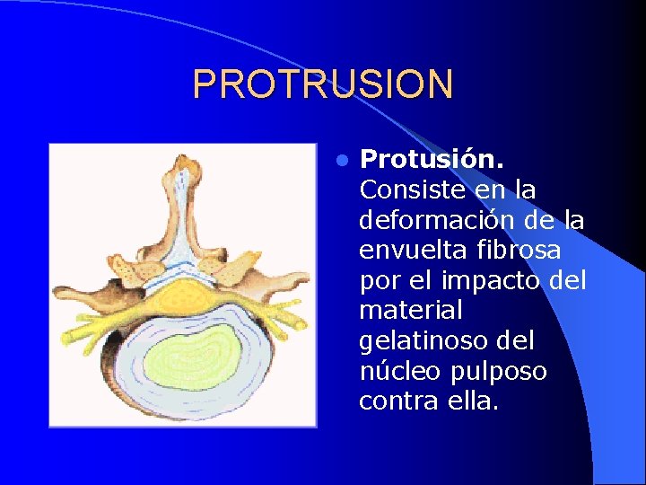 PROTRUSION l Protusión. Consiste en la deformación de la envuelta fibrosa por el impacto