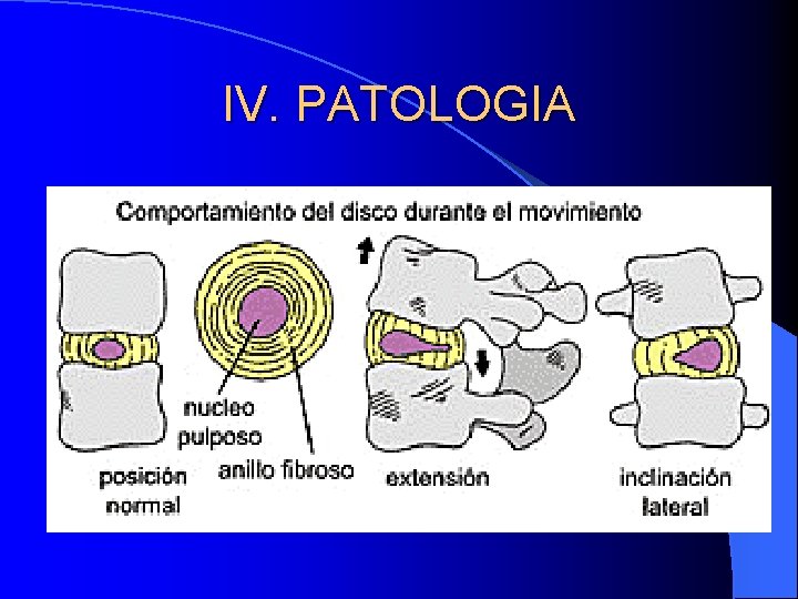 IV. PATOLOGIA 