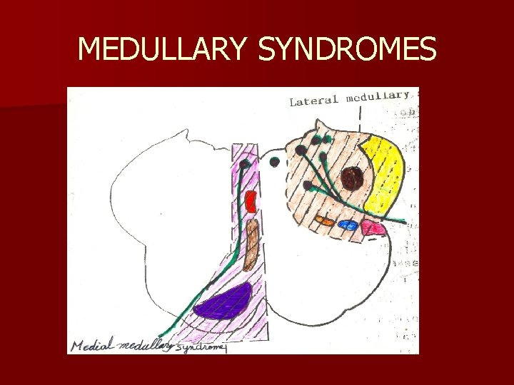 MEDULLARY SYNDROMES 