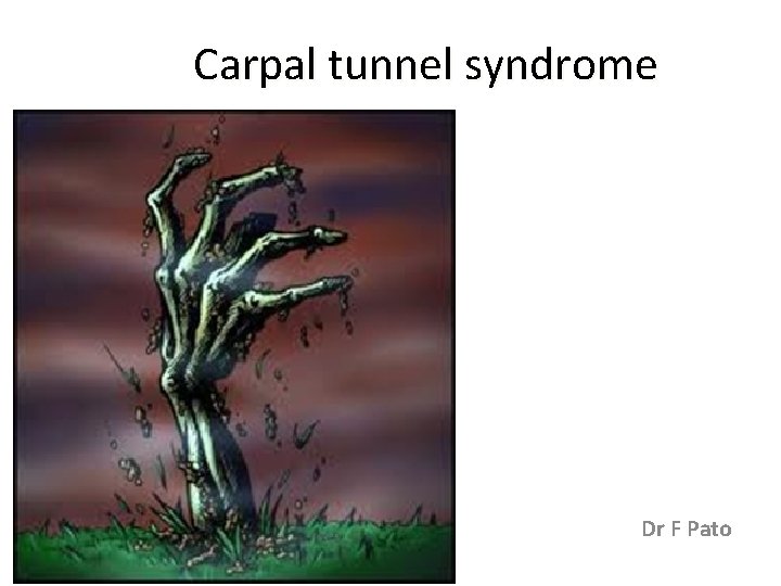 Carpal tunnel syndrome Dr F Pato 