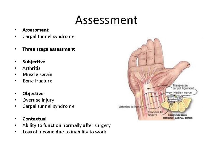 Assessment • • Assessment Carpal tunnel syndrome • Three stage assessment • • Subjective