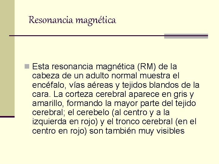 Resonancia magnética n Esta resonancia magnética (RM) de la cabeza de un adulto normal