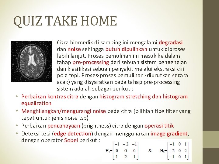 QUIZ TAKE HOME • • Citra biomedik di samping ini mengalami degradasi dan noise