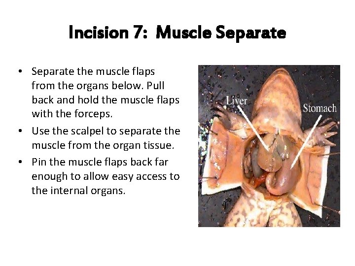 Incision 7: Muscle Separate • Separate the muscle flaps from the organs below. Pull