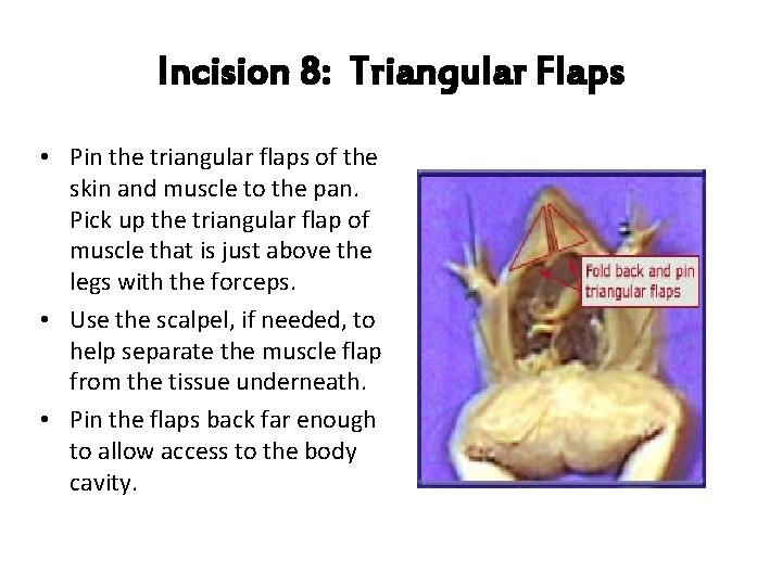 Incision 8: Triangular Flaps • Pin the triangular flaps of the skin and muscle