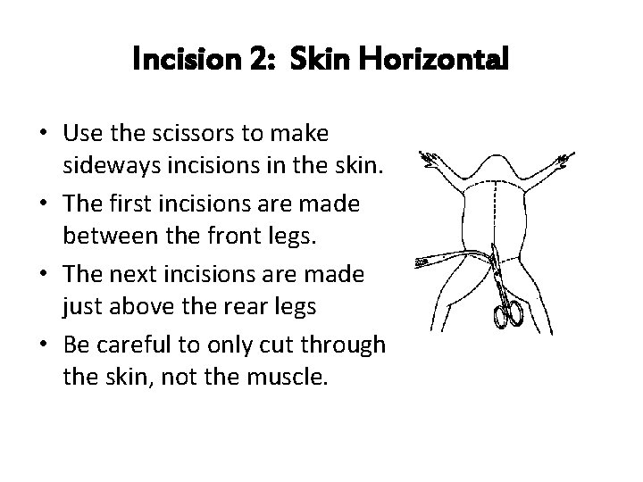 Incision 2: Skin Horizontal • Use the scissors to make sideways incisions in the