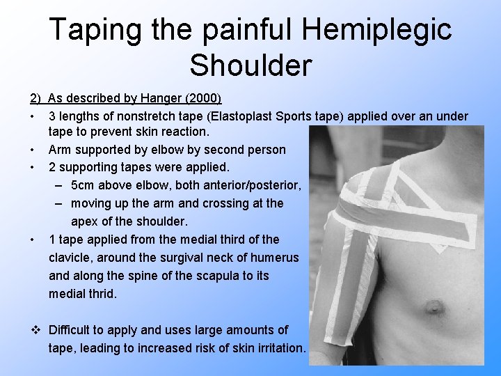 Taping the painful Hemiplegic Shoulder 2) As described by Hanger (2000) • 3 lengths