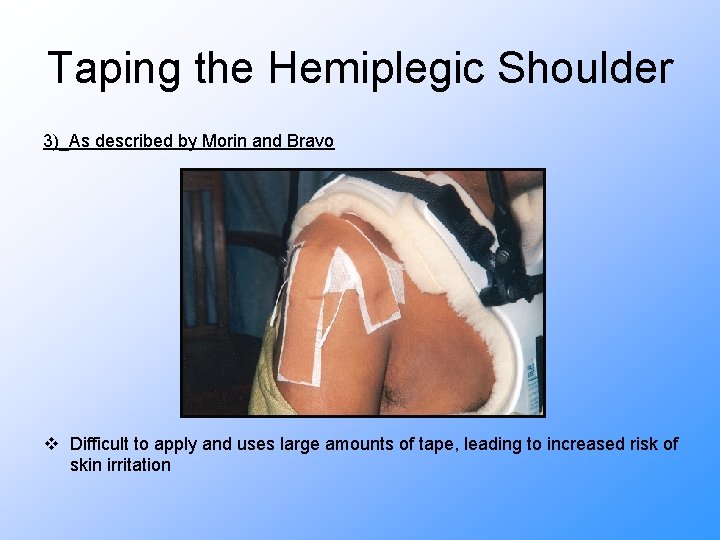 Taping the Hemiplegic Shoulder 3)_As described by Morin and Bravo v Difficult to apply