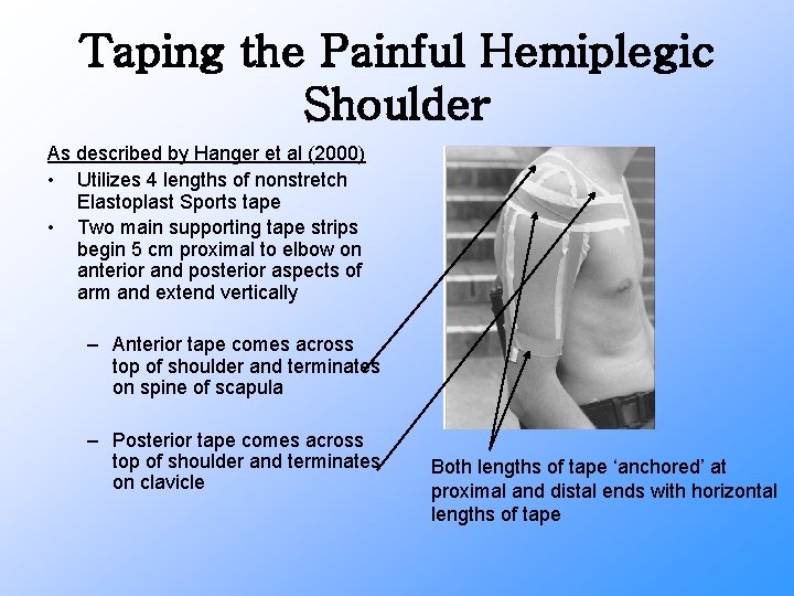 Taping the Painful Hemiplegic Shoulder As described by Hanger et al (2000) • Utilizes