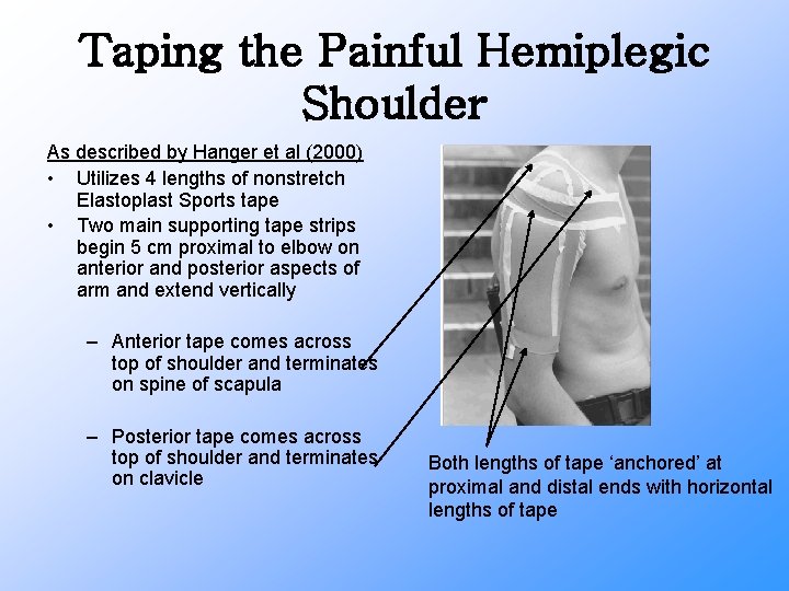 Taping the Painful Hemiplegic Shoulder As described by Hanger et al (2000) • Utilizes