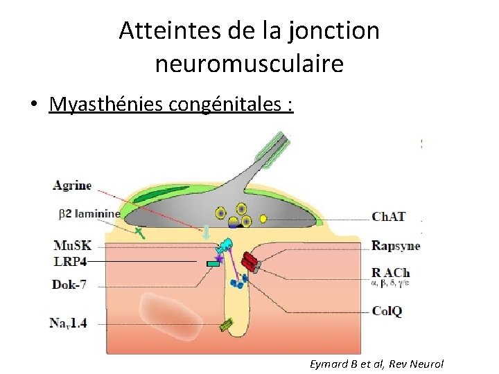 Atteintes de la jonction neuromusculaire • Myasthénies congénitales : Eymard B et al, Rev