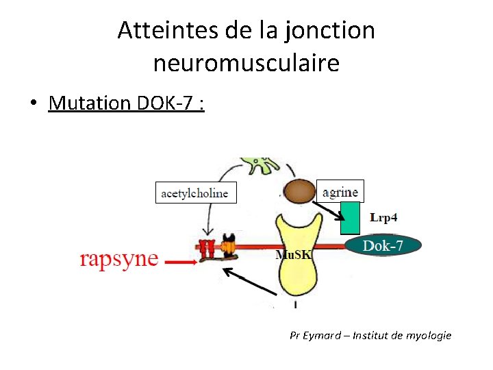 Atteintes de la jonction neuromusculaire • Mutation DOK-7 : Pr Eymard – Institut de
