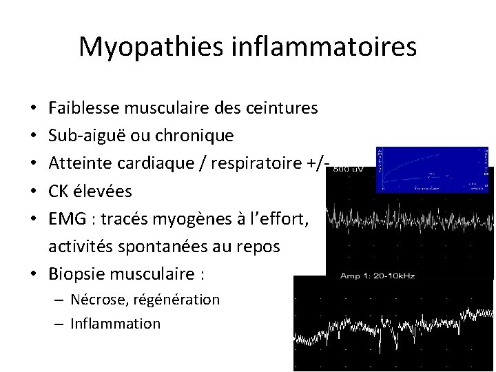 Myopathies inflammatoires Faiblesse musculaire des ceintures Sub-aiguë ou chronique Atteinte cardiaque / respiratoire +/CK