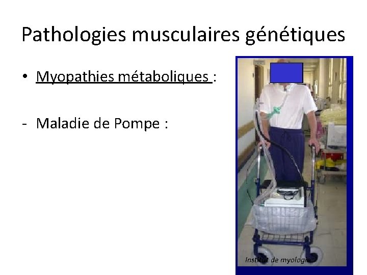 Pathologies musculaires génétiques • Myopathies métaboliques : - Maladie de Pompe : Institut de