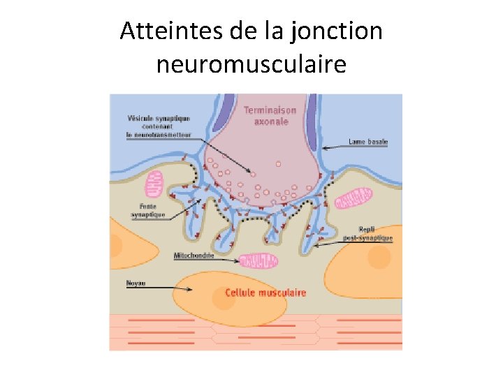 Atteintes de la jonction neuromusculaire 