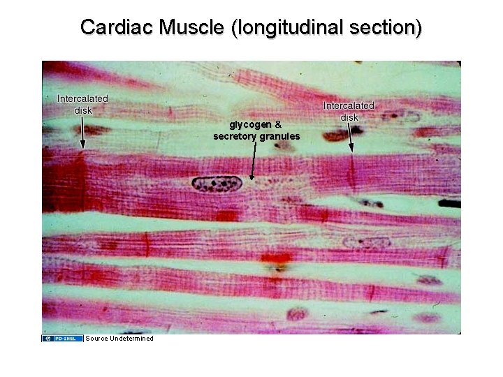 Cardiac Muscle (longitudinal section) glycogen & secretory granules Source Undetermined 