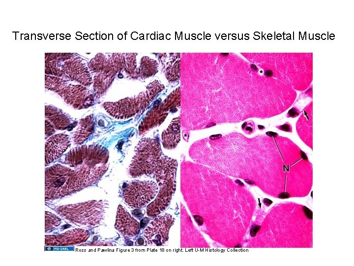 Transverse Section of Cardiac Muscle versus Skeletal Muscle Ross and Pawlina Figure 3 from