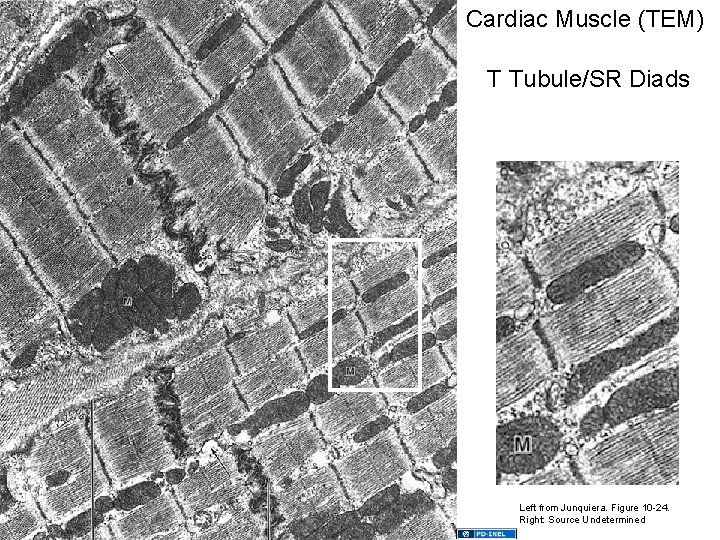 Cardiac Muscle (TEM) T Tubule/SR Diads Left from Junquiera. Figure 10 -24. Right: Source