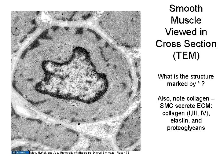 Smooth Muscle Viewed in Cross Section (TEM) What is the structure marked by * Smooth Muscle Viewed in Cross Section (TEM) What is the structure marked by *