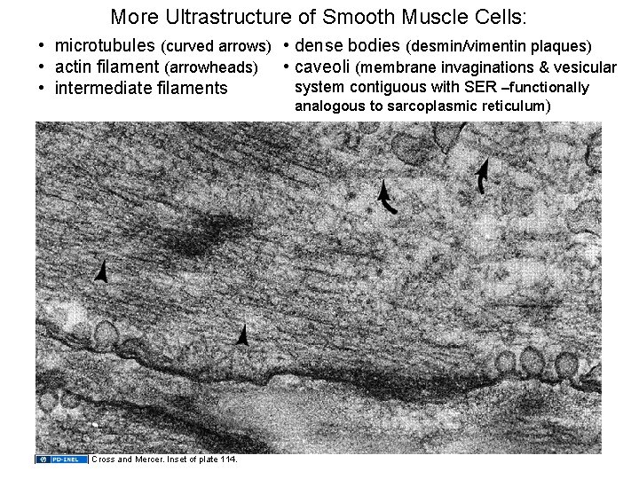 More Ultrastructure of Smooth Muscle Cells: • microtubules (curved arrows) • dense bodies (desmin/vimentin